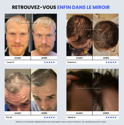 Sérum Densifiant+