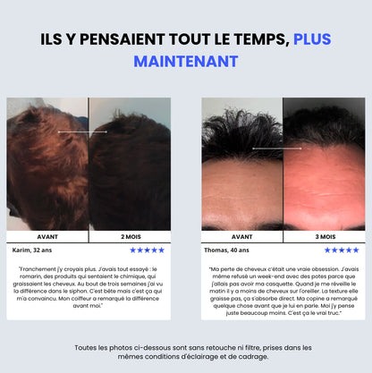 Sérum Densifiant+